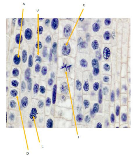 Solved Mitosis Pre Lab Questions 1 What Are Chromosomes Made Of 10