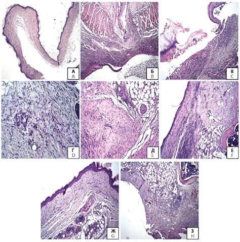 Histological Examination With Hematoxylin And Eosin Staining