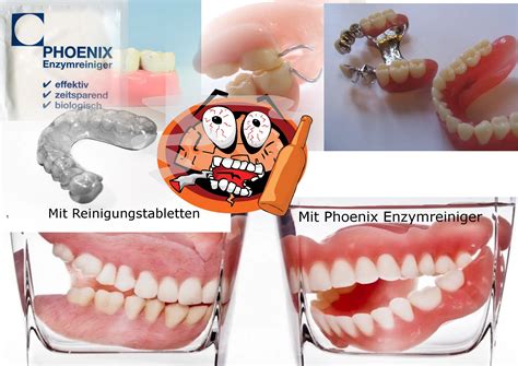 Zahnprothese Reinigen