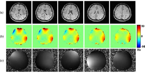 Figure From High Resolution D Spin Echo Mrsi Using Interleaved Water