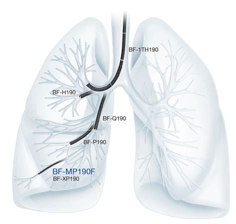 Radial Ebus Ultrathin Bronchoscopy Procedure Guide Olympus