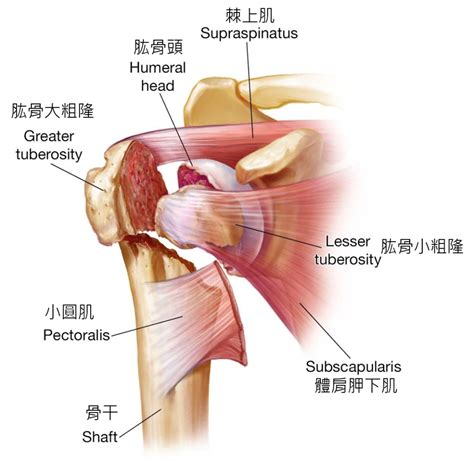 Proximal Humerous Part