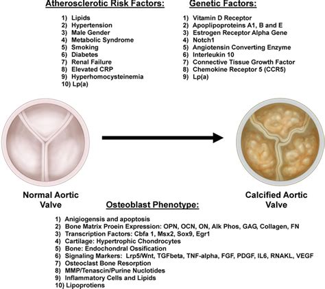 The Lipid Hypothesis In Calcific Aortic Valve Disease