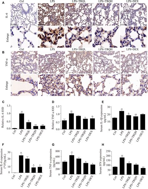 Frontiers Tanreqing Inhibits LPS Induced Acute Lung Injury In Vivo