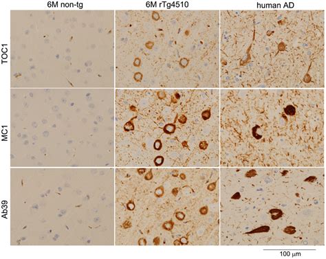 Frontiers Characteristics Of Tau Oligomers