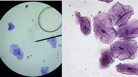 Human Cheek Cells Under A Microscope