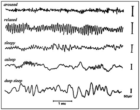 Eeg Waveforms For Different Physical States As The Level Of Physical