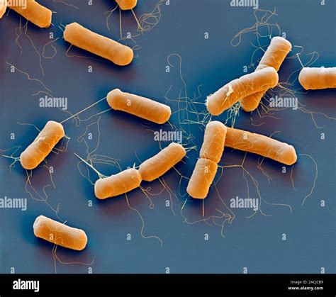 Bacillus cereus bacteria, coloured scanning electron micrograph (SEM ...