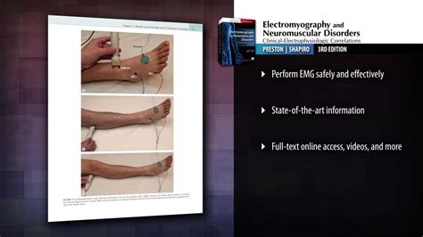 Electromyography And Neuromuscular Disorders Rd Edition Youtube