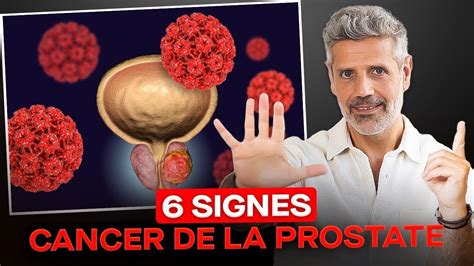 6 Symptômes Du Cancer De La Prostate YouTube