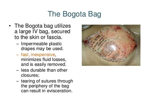 Bogota Bag For Temporary Abdominal Closure