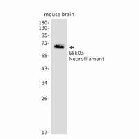 Neurofilament Light Polypeptide Rabbit MAb NewEast Biosciences