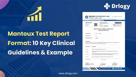 Mantoux Test Report Format 10 Key Clinical Guidelines And Example Drlogy