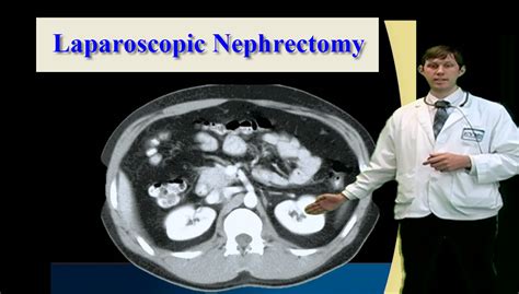 Surgical Subspecialties: Laparoscopic Nephrectomy - Anatomy Guy