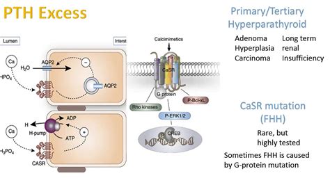 Hypercalcemia And Hypocalcemia Youtube