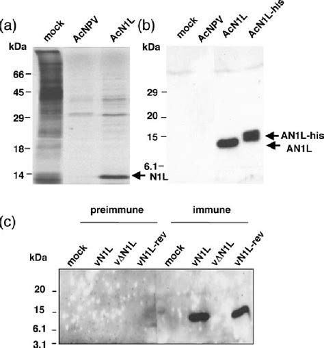 Expression Of The N1l Protein By Acnpv And Vv A Metabolic Labelling Download Scientific