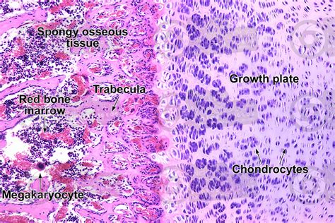 Bone Marrow Histology Labeled