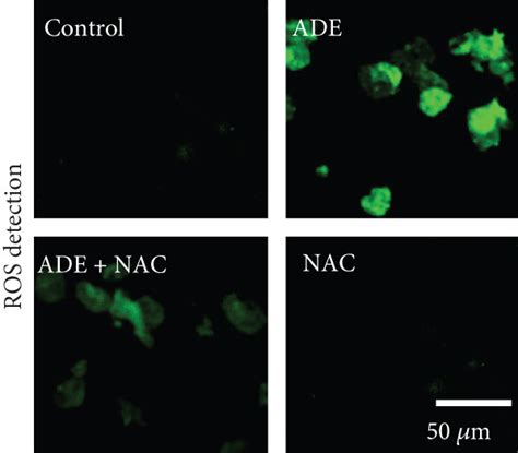 Effect Of Nac On Ers And Apoptosis A Nac Markedly Improved Ht