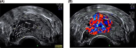 Ultrasound In Labor Clinical Practice Guideline And Recommendation By