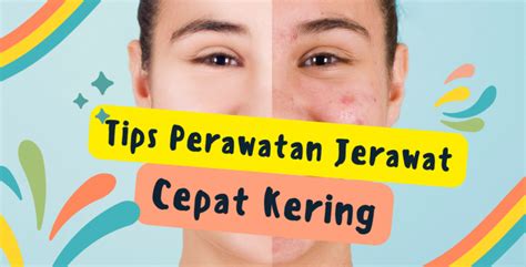 Tips Perawatan Wajah Berjerawat Cepat Kering Bersama SCA