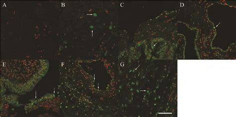 Immunofluorescent Detection Of Growth Hormone Secretagogue Receptor 1a