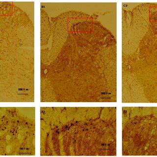 Immunohistochemistry In L L Spinal Cord Segments Showing That There