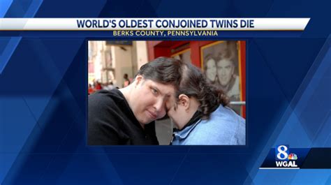 Oldest living conjoined twins die at 62 in Pennsylvania