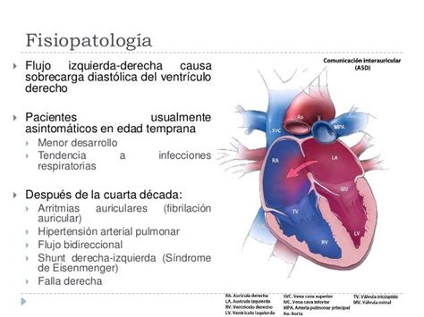 Cardiopatías Congénitas En El Adulto