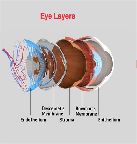 How Can Scleral Lenses Help Corneal Dystrophy Specialty Lens And