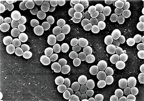 Morphology And Cultural Characteristics Of Staphylococcus Aureus