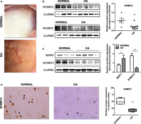 Down‐regulated In Oa Cartilage Sfmbt2 Contributes To Nf‐κb‐mediated