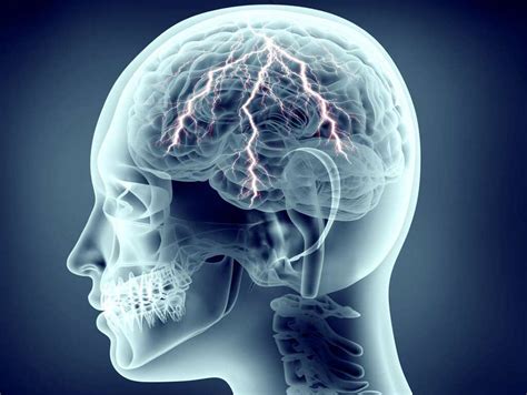 Encephalitis: 10 Symptoms of Encephalitis