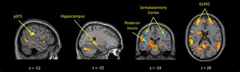 Frontiers Genetic Imaging Of The Association Of Oxytocin Receptor