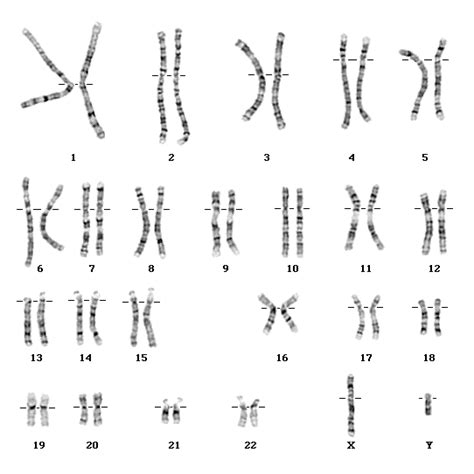 Cariotipo masculino femenino Reproducion Herencia y Evolución