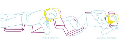 Therapeutic Positioning System Posture Care Specialist Posture