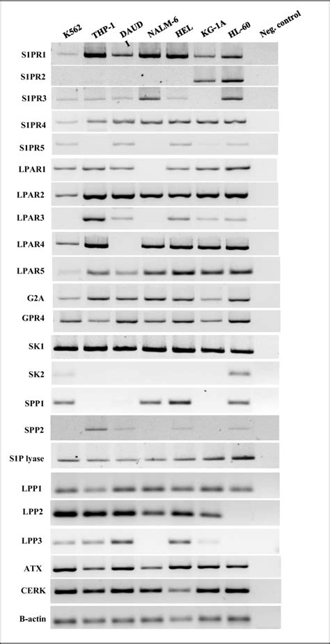 Human Malignant Hematopoietic Cell Lines Express Functional S P