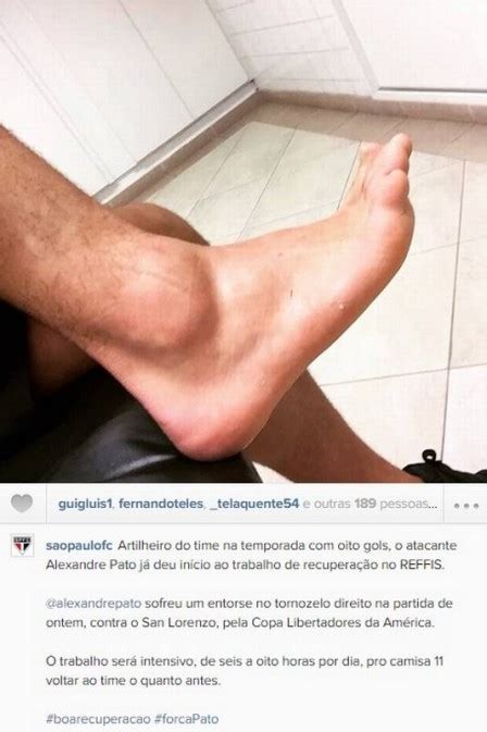 Alexandre Pato inicia tratamento e São Paulo posta foto de tornozelo do