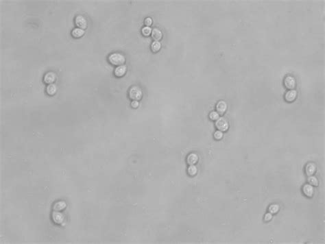 Budding Yeast Budding Yeast Saccharomyces Cerevisiae Gr Flickr