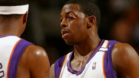 NBA Injuries: Top 10 Worst Injuries These Basketball Players Had Page 9