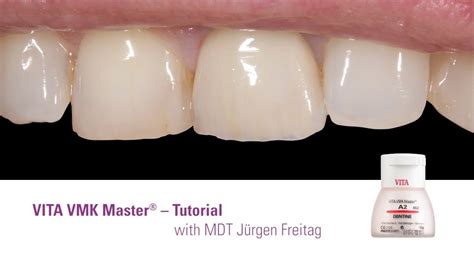 Tutorial Vita Vmk Master With Master Dental Technician J Rgen Freitag