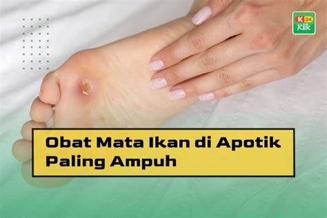 obat mata ikan  apotik  ampuh kklik