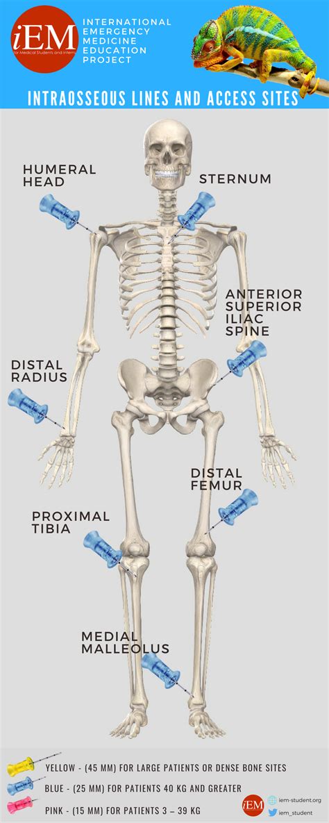 Intraosseous line access sites – International Emergency Medicine ...