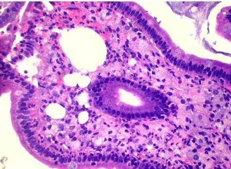 Figure H E Section Of Duodenal Mucosa At X Magnification