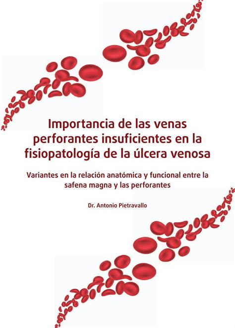 Pdf Importancia De Las Venas Perforantes Insuficientes En La