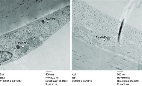 Localization Of Pgz Nps And Rhod Nps In Hcmec D3 By Tem Note Cells Download Scientific