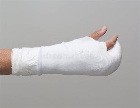 Bandaged arm and fingers stock image. Image of white - 15947415