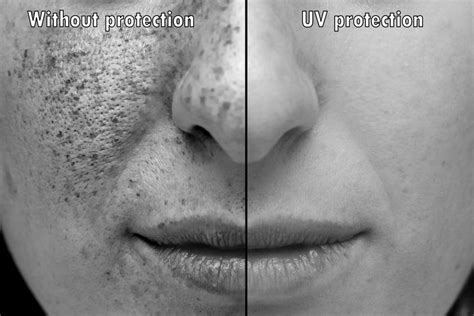 New Compound May Prevent Skin Aging Caused By Sun Exposure Nutrition Review