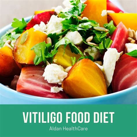 Best Vitiligo Food Diet | How To Cure Vitiligo Fast Naturally