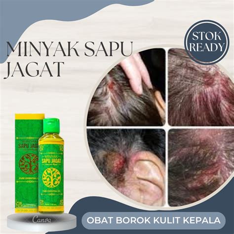 Jual Obat Kulit Kepala Borok Obat Jamur Kulit Kepala Obat Kepala