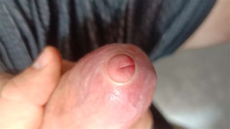 Tight Foreskin Large Cock Play Playing With My Uncut Foreskin Phimosis Cock Pornhub Gay